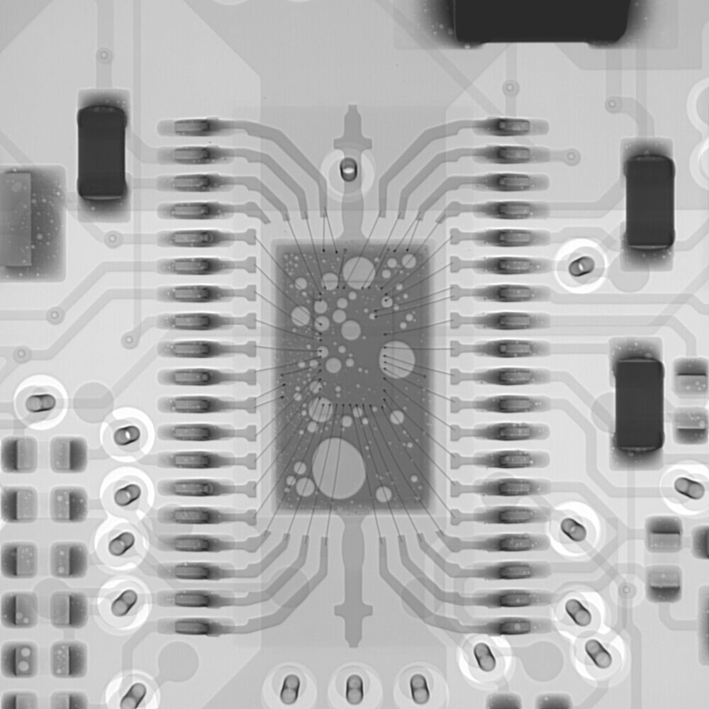 Integrated circuit (IC) in the X-ray image