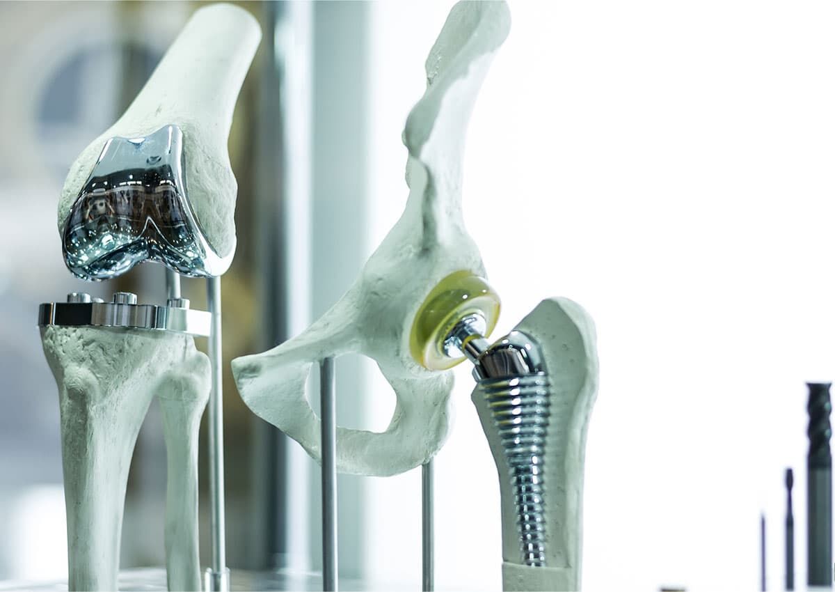 Spark emission spectroscopy in medical technology