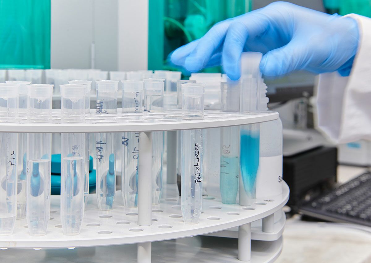 Probenvorbereitung bei der Hochleistungsflüssigkeitschromatographie (HPLC)