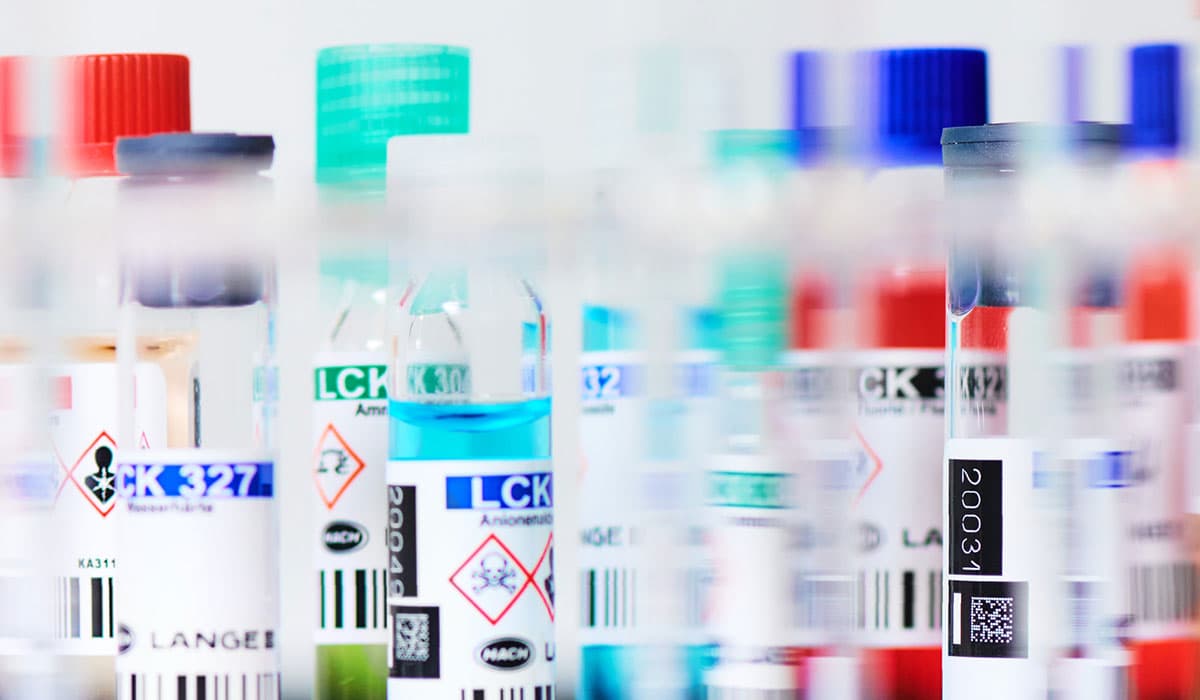 Chemische Analytik  von Wasserproben