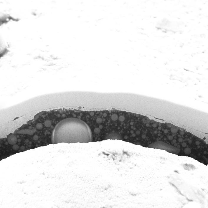 FIB-SEM microscopy