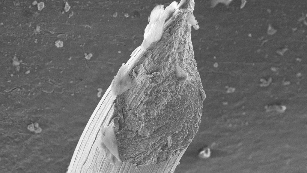 scanning electron microscopy